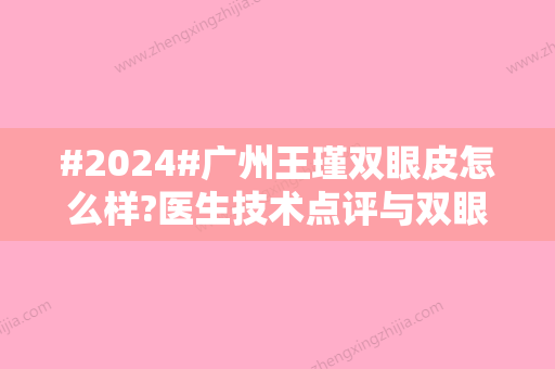 #2024#广州王瑾双眼皮怎么样?医生技术点评与双眼皮案例详情