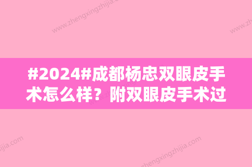 #2024#成都杨忠双眼皮手术怎么样？附双眼皮手术过程和医生资料