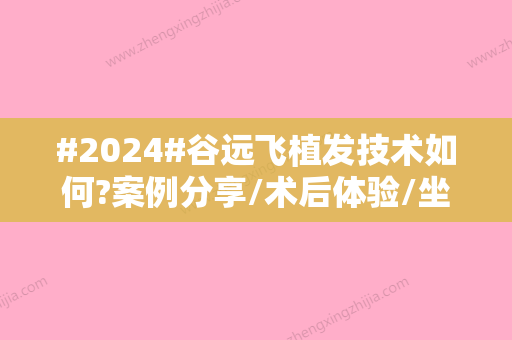 #2024#谷远飞植发技术如何?案例分享/术后体验/坐诊医院简介