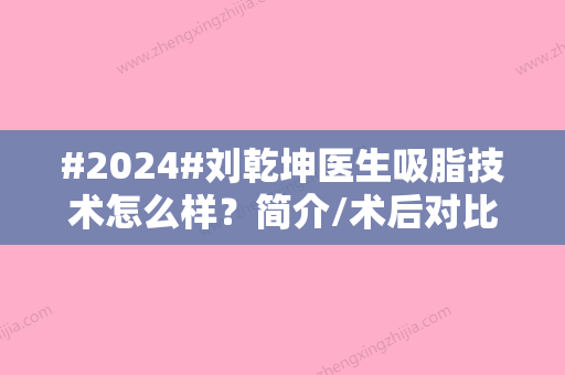 #2024#刘乾坤医生吸脂技术怎么样？简介/术后对比案例/实力口碑干货满满