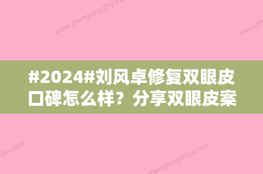 #2024#刘风卓修复双眼皮口碑怎么样？分享双眼皮案例/坐诊医院简介