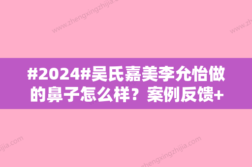 #2024#吴氏嘉美李允怡做的鼻子怎么样？案例反馈+医生简介，昆明人气优选！