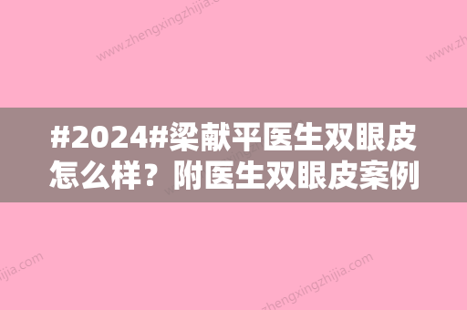 #2024#梁献平医生双眼皮怎么样？附医生双眼皮案例/坐诊医院简介