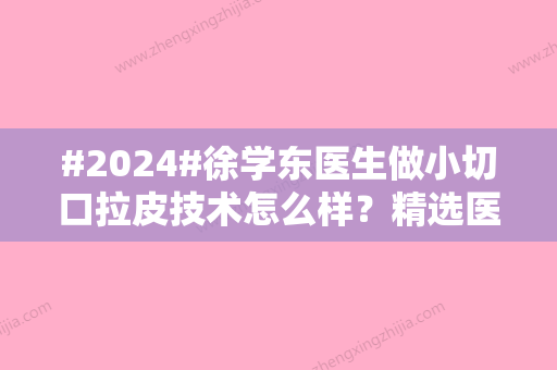 #2024#徐学东医生做小切口拉皮技术怎么样？精选医生案例和小切口拉皮技术详解