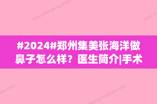 #2024#郑州集美张海洋做鼻子怎么样？医生简介|手术风格|价格详情