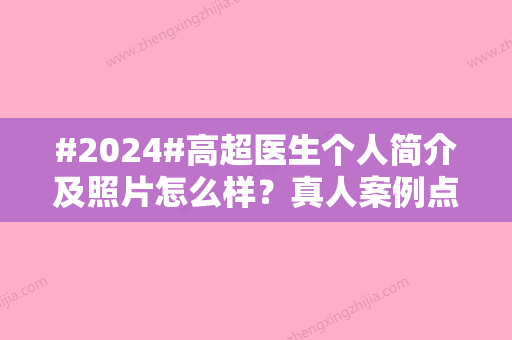 #2024#高超医生个人简介及照片怎么样？真人案例点评	，价格详情了解