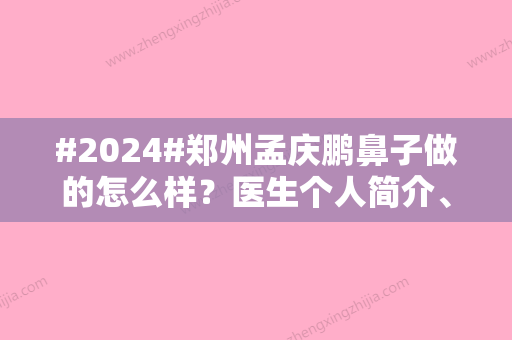 #2024#郑州孟庆鹏鼻子做的怎么样？医生个人简介、口碑评价	、出诊医院揭晓！