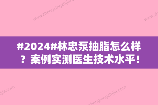 #2024#林忠泵抽脂怎么样？案例实测医生技术水平！目前就职医院介绍