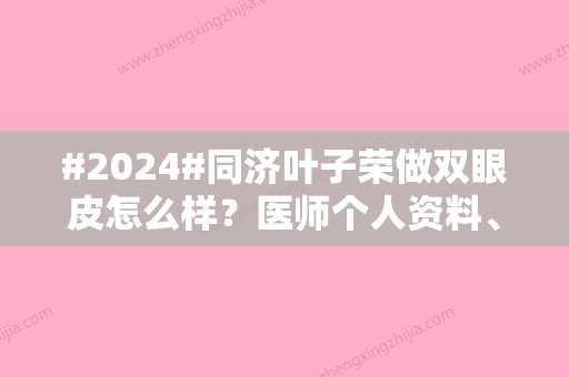 #2024#同济叶子荣做双眼皮怎么样？医师个人资料、网友评价