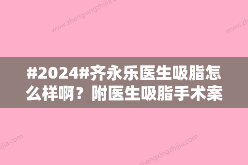 #2024#齐永乐医生吸脂怎么样啊？附医生吸脂手术案例及个人信息