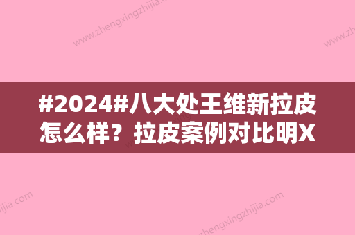 #2024#八大处王维新拉皮怎么样？拉皮案例对比明X吗？医生技术实力怎么样？