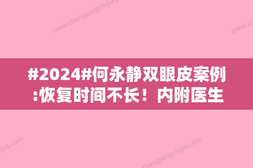 #2024#何永静双眼皮案例:恢复时间不长！内附医生简介、价格