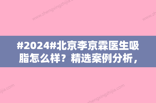 #2024#北京李京霖医生吸脂怎么样？精选案例分析，更新价格表