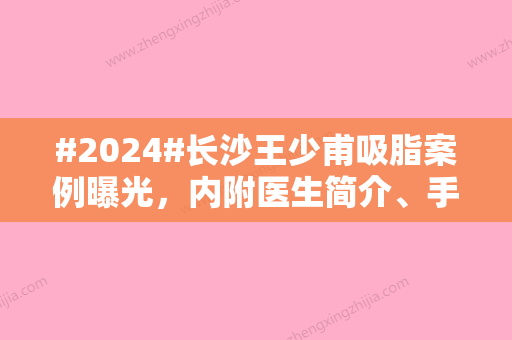 #2024#长沙王少甫吸脂案例曝光，内附医生简介、手术价格