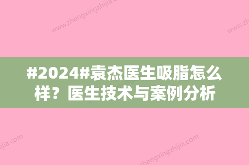 #2024#袁杰医生吸脂怎么样？医生技术与案例分析