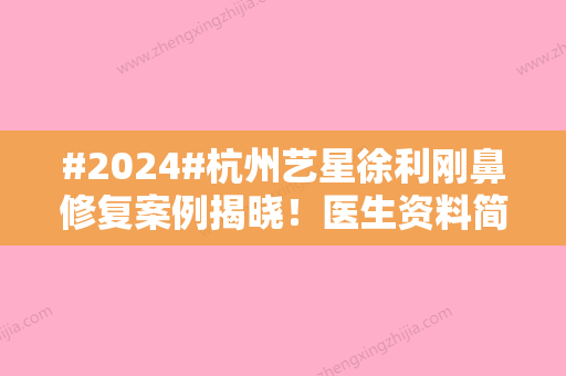 #2024#杭州艺星徐利刚鼻修复案例揭晓！医生资料简介及坐诊医院介绍