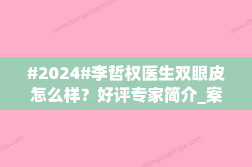 #2024#李哲权医生双眼皮怎么样？好评专家简介_案例赏析