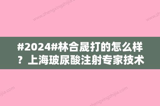 #2024#林合晟打的怎么样？上海玻尿酸注射专家技术点评