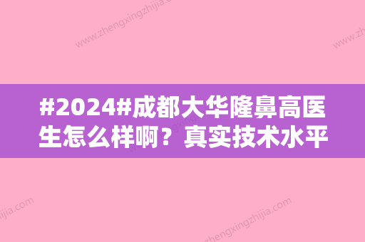 #2024#成都大华隆鼻高医生怎么样啊？真实技术水平透露，成都隆鼻医生选入！