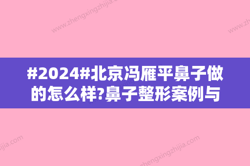 #2024#北京冯雁平鼻子做的怎么样?鼻子整形案例与医生信息介绍