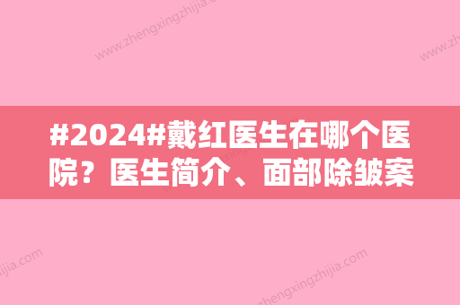 #2024#戴红医生在哪个医院？医生简介、面部除皱案例赏析