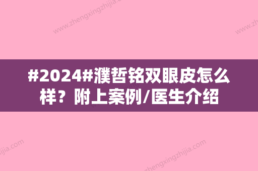 #2024#濮哲铭双眼皮怎么样？附上案例/医生介绍