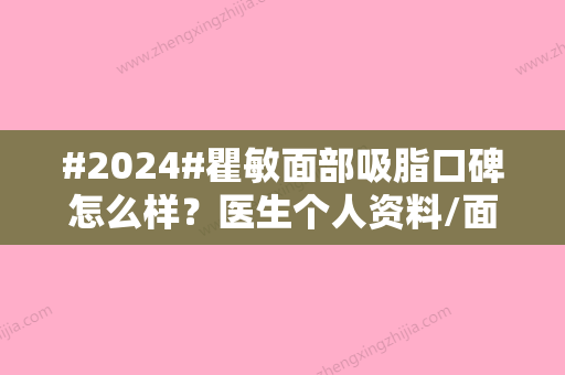 #2024#瞿敏面部吸脂口碑怎么样？医生个人资料/面部吸脂案例/价格表