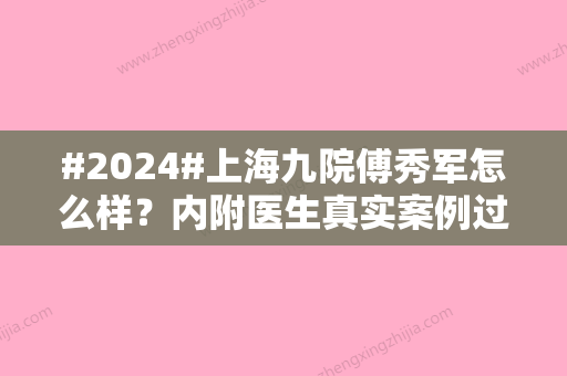 #2024#上海九院傅秀军怎么样？内附医生真实案例过程！