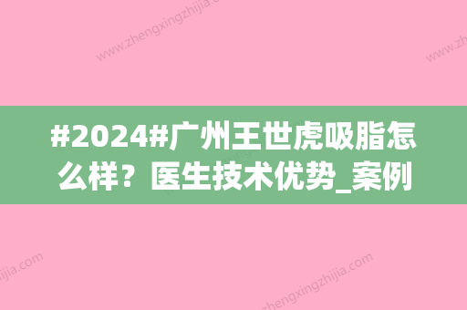 #2024#广州王世虎吸脂怎么样？医生技术优势_案例_价格表一览