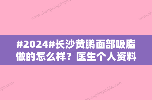 #2024#长沙黄鹏面部吸脂做的怎么样？医生个人资料、技术特色	、案例一览