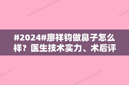 #2024#廖祥钧做鼻子怎么样？医生技术实力	、术后评价揭晓！深圳富华人气优选~