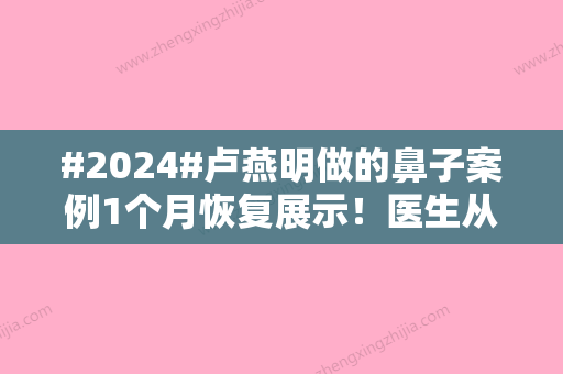 #2024#卢燕明做的鼻子案例1个月恢复展示！医生从业经历，实力优势，口碑评价！