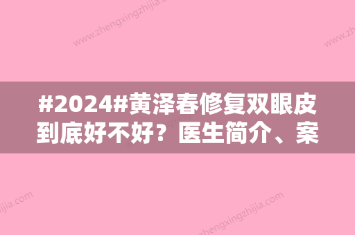 #2024#黄泽春修复双眼皮到底好不好？医生简介、案例测评	，术前排雷！