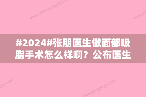 #2024#张朋医生做面部吸脂手术怎么样啊？公布医生个人信息与技术水平情况！