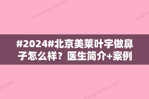 #2024#北京美莱叶宇做鼻子怎么样？医生简介+案例反馈，美鼻探照灯！