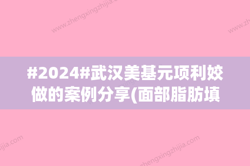 #2024#武汉美基元项利姣做的案例分享(面部脂肪填充):脸型饱满有元气！