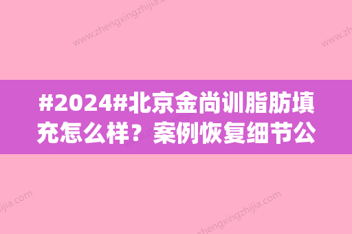 #2024#北京金尚训脂肪填充怎么样？案例恢复细节公开|项目价格表一览！