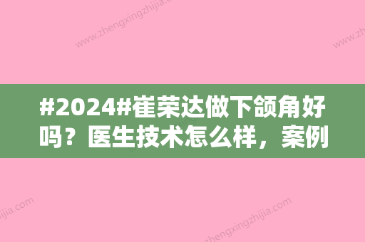 #2024#崔荣达做下颌角好吗？医生技术怎么样	，案例亲测反馈！