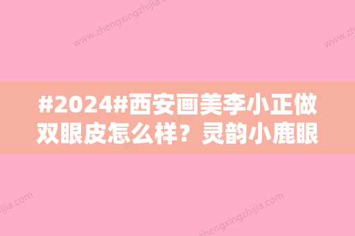 #2024#西安画美李小正做双眼皮怎么样？灵韵小鹿眼做的比较多！