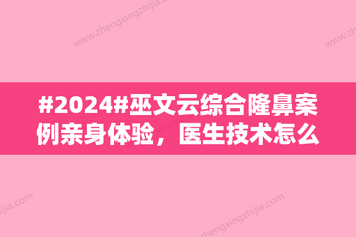 #2024#巫文云综合隆鼻案例亲身体验	，医生技术怎么样？手术优势一一展示