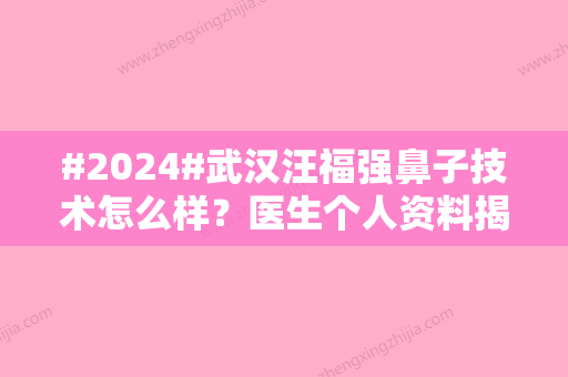 #2024#武汉汪福强鼻子技术怎么样？医生个人资料揭晓，附坐诊医院简介