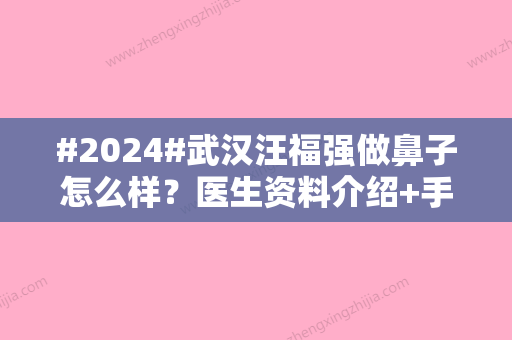 #2024#武汉汪福强做鼻子怎么样？医生资料介绍+手术风格评价+价格表