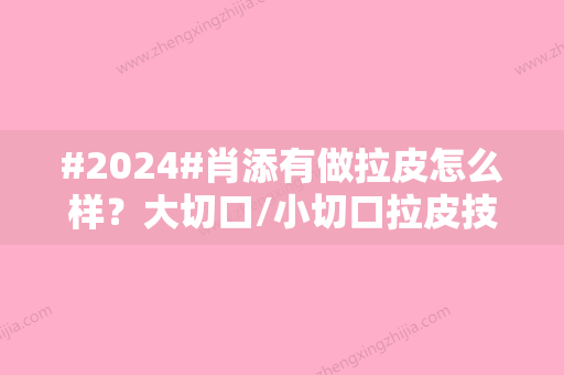 #2024#肖添有做拉皮怎么样？大切口/小切口拉皮技术点评+坐诊医院信息