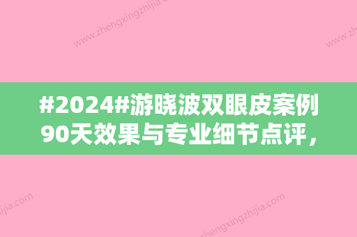 #2024#游晓波双眼皮案例90天效果与专业细节点评	，医生口碑好不好？