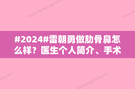 #2024#雷朝勇做肋骨鼻怎么样？医生个人简介、手术风格	、口碑评价