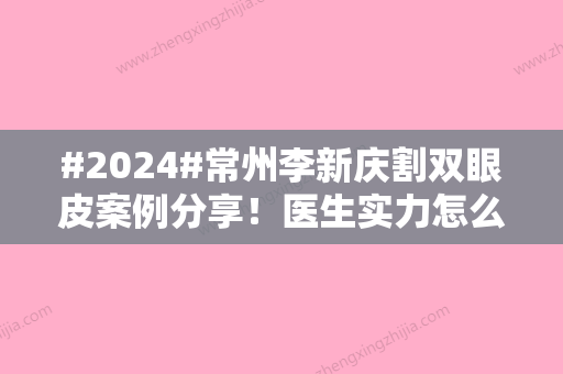 #2024#常州李新庆割双眼皮案例分享！医生实力怎么样，邀你品鉴！