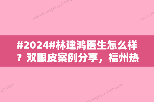 #2024#林建鸿医生怎么样？双眼皮案例分享，福州热门之星！