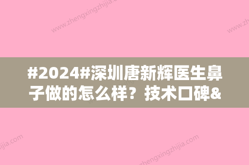 #2024#深圳唐新辉医生鼻子做的怎么样？技术口碑&个人简介&鼻整形案例