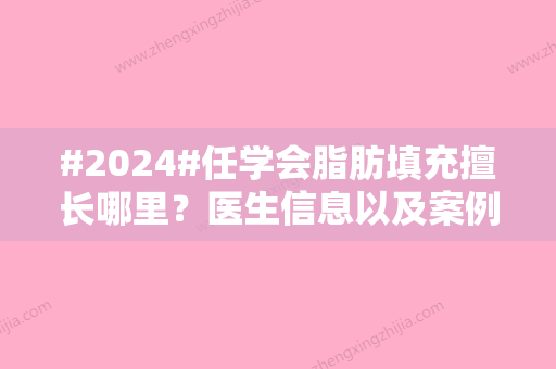 #2024#任学会脂肪填充擅长哪里？医生信息以及案例反馈