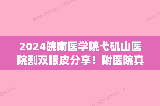 2024皖南医学院弋矶山医院割双眼皮分享！附医院真实案例+价格表(弋矶山医院整形)